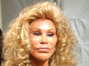 jocelyn-wildenstein
